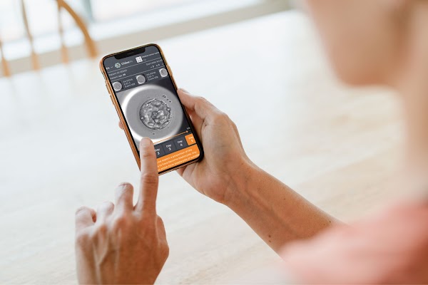 AI-powered IVF solution CHLOE™ on phone screen