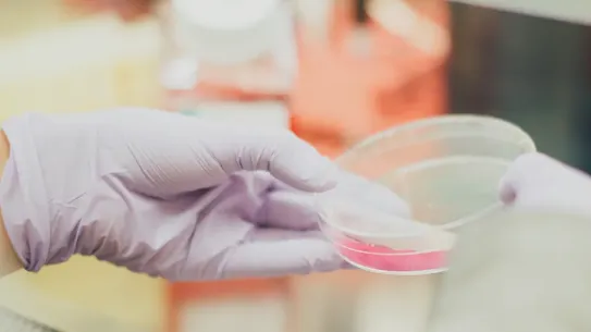 A photograph of a researcher handling a lab sample, used to illustrate the AlphaFold and GARDP case study. The image represents the scientific efforts to combat antibiotic-resistant infections, highlighting how AI-powered protein structure predictions are accelerating the development of new treatments for global health challenges.