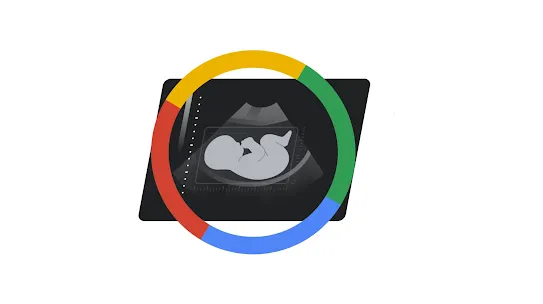 An illustration depicting a fetal ultrasound scan displayed on a dark screen, viewed through a circular border with four colored segments in red, yellow, green, and blue